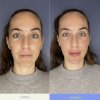 Full Face - Eva Garrigós Gracia