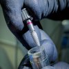implantes de excelente calidad - Eduardo Alvarado