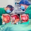 lipoma en region fronto-parietal - Eduardo Alvarado