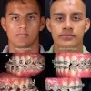 Asimetria facial - Eduardo Alvarado