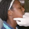 luxacion mandibular - Eduardo Alvarado