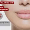 Relleno de Labios - Estética Villaverde Alto