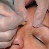 Foto de Centro Dermatológico Dr. Galváñ
